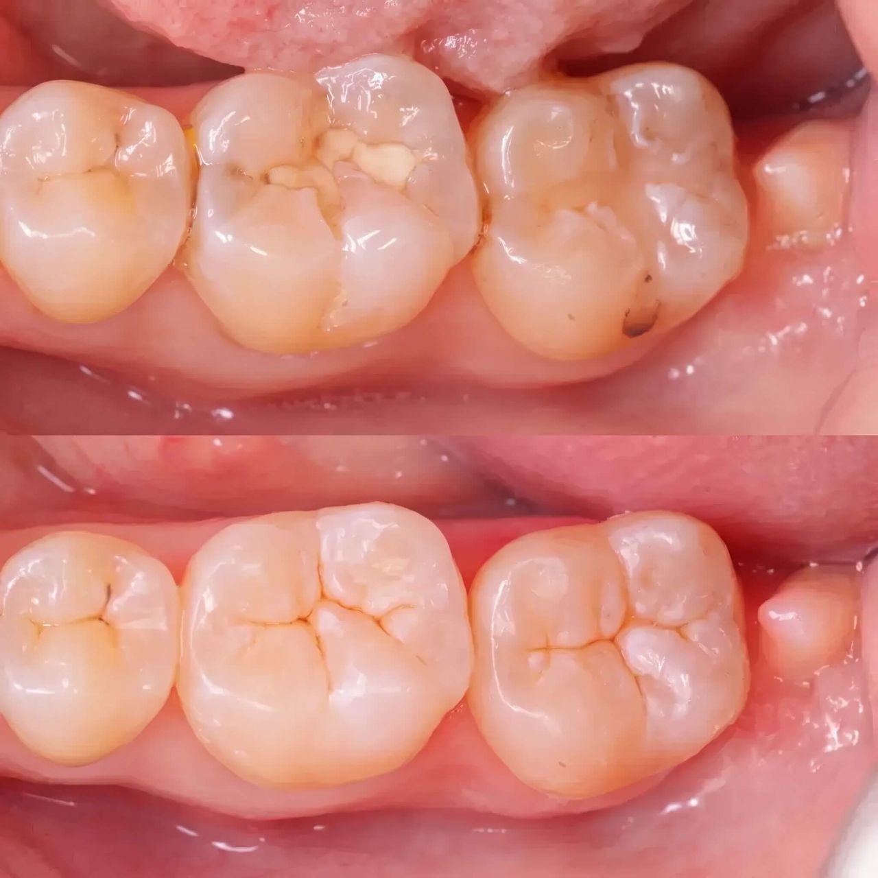 Before and after sculpting by Kayla Madison