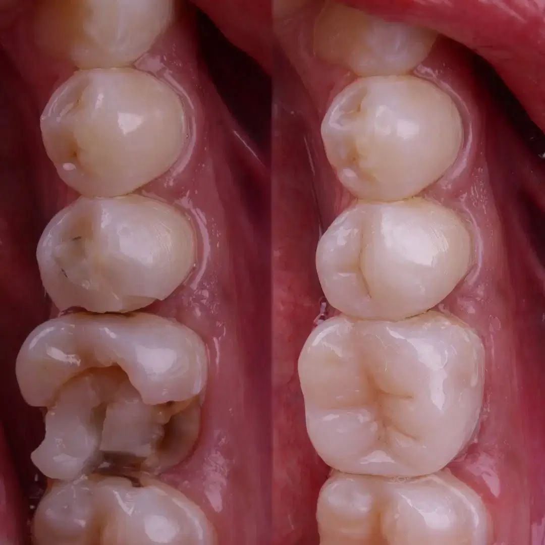 Before and after sculpting by Lucas Robinson