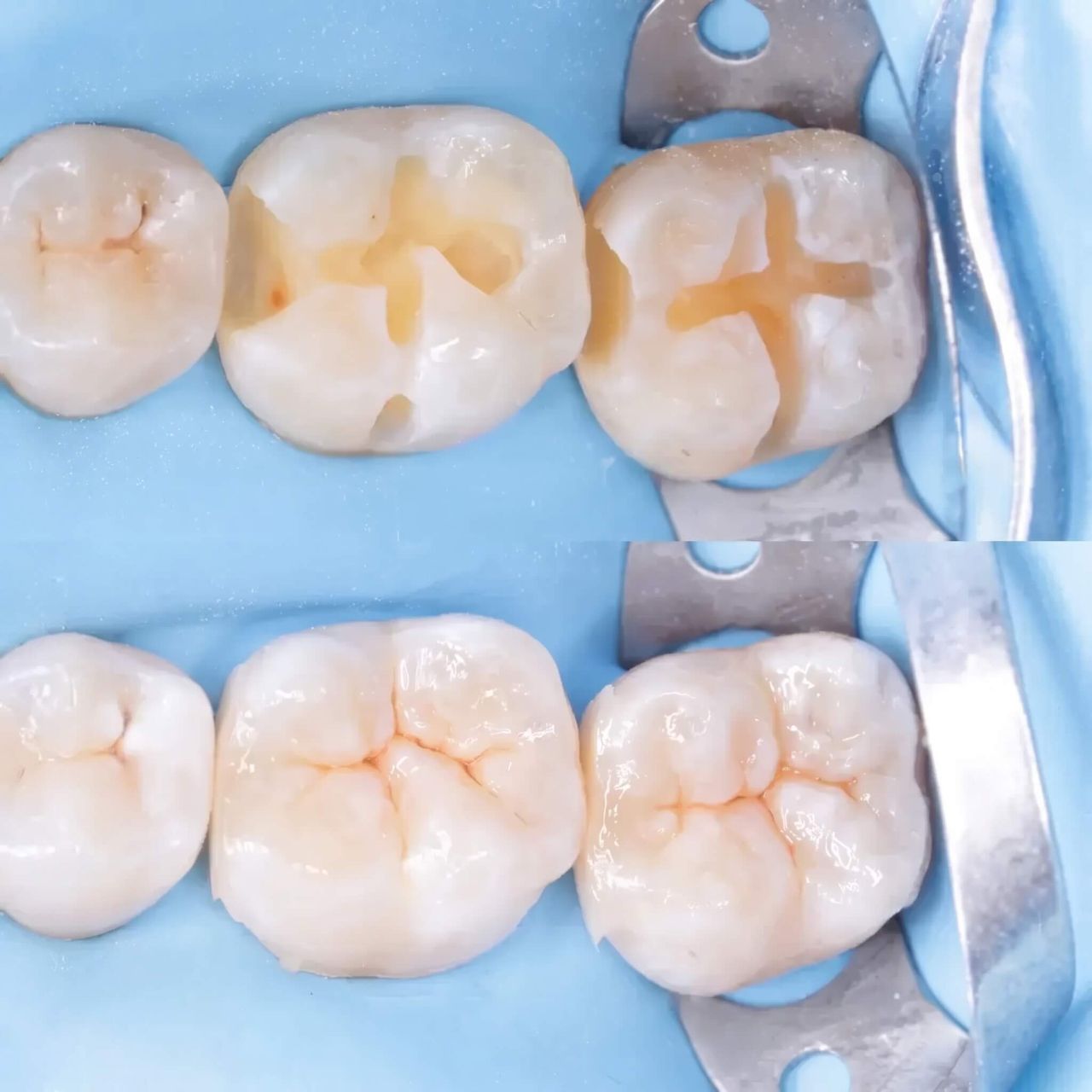 Before and after sculpting by Emily Carter