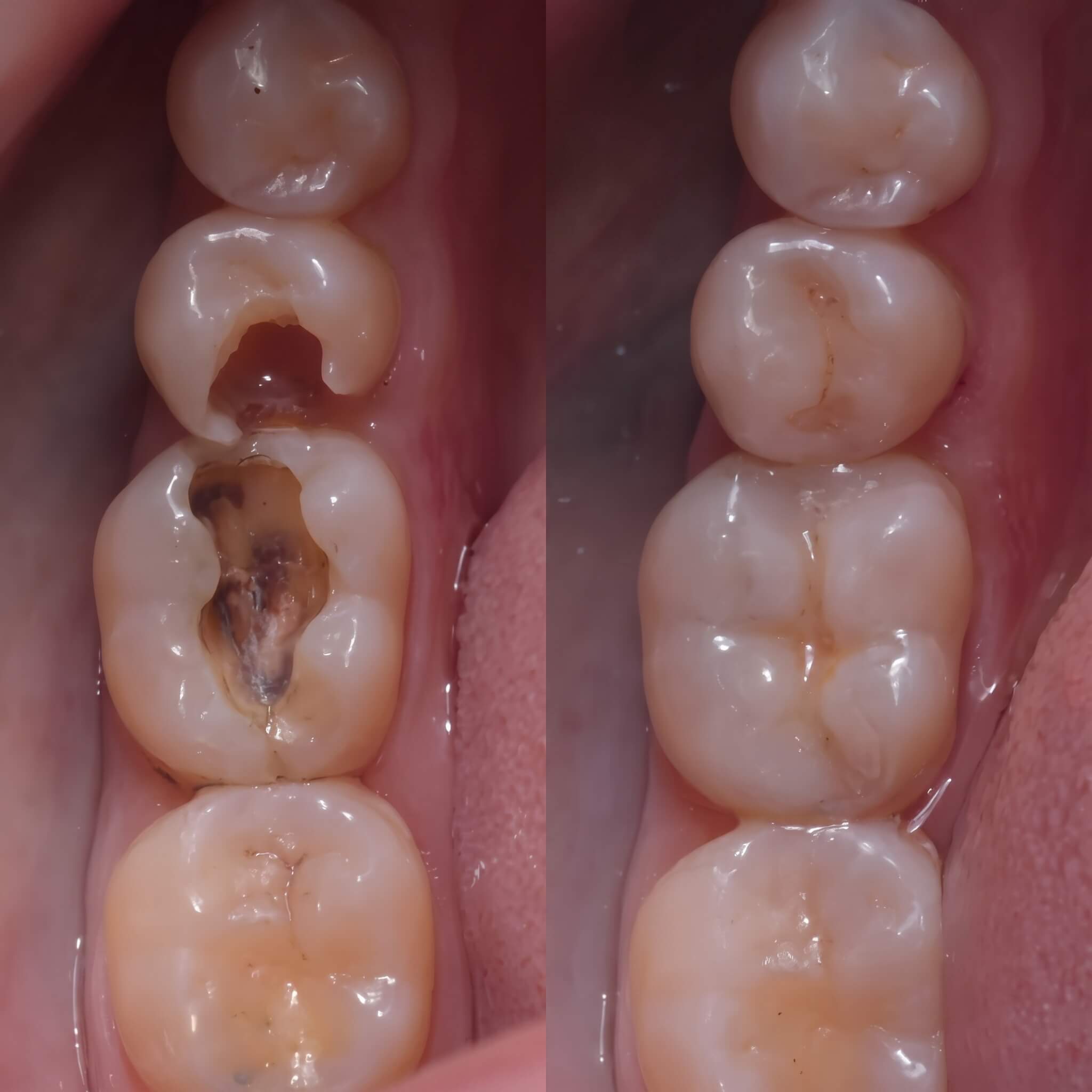 Before and after sculpting by Emily Carter